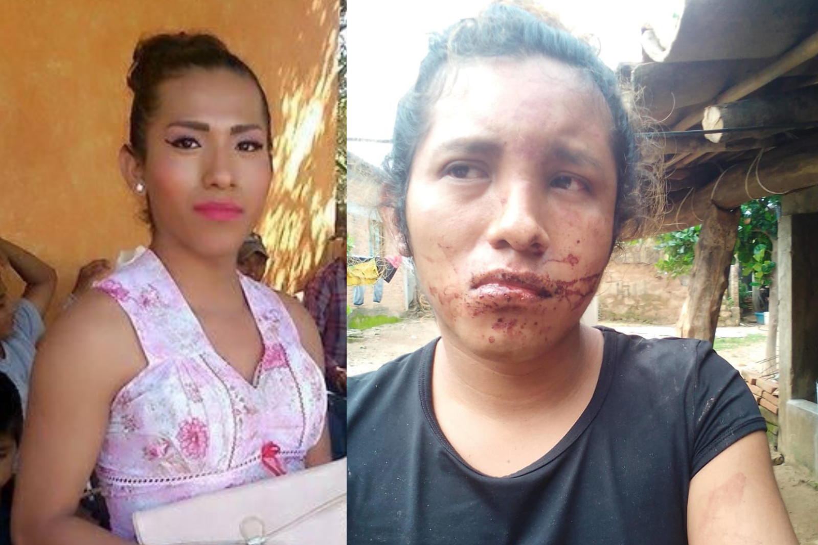 Alerta DDHPO por crímenes de odio y discriminación contra mujeres trans